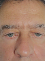 Gyimesi László